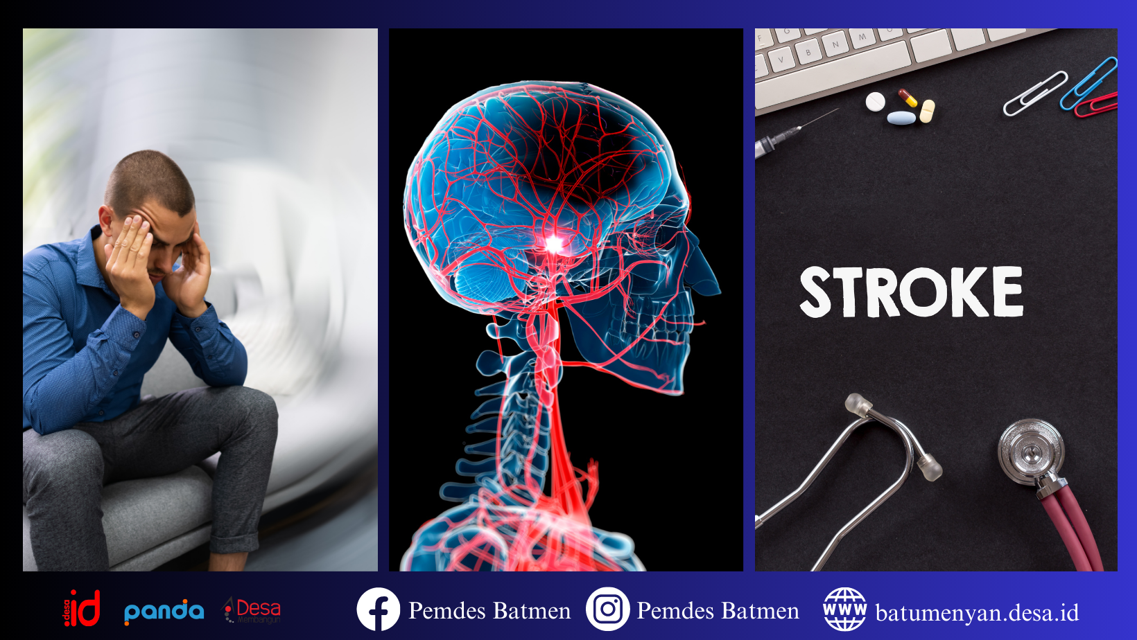 Mengenal Lebih Dekat Stroke